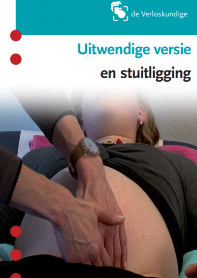 Uitwendige versie en stuitligging